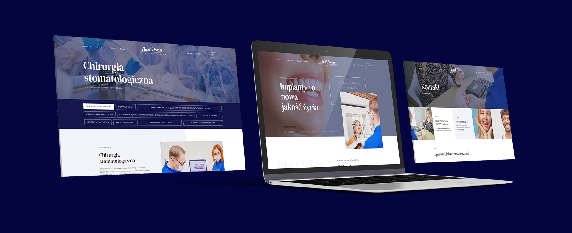 Dobosz Implanty, czyli strona piękna jak uśmiech